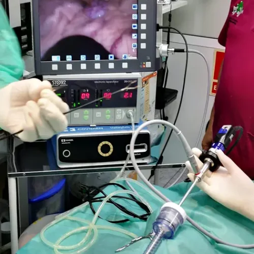 cveuropa-LAPAROSCOPIA_02